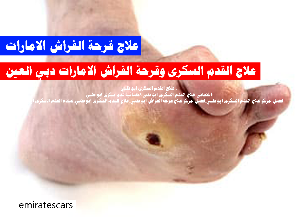 علاج القدم السكرى وقرحة الفراش الامارات دبي العين