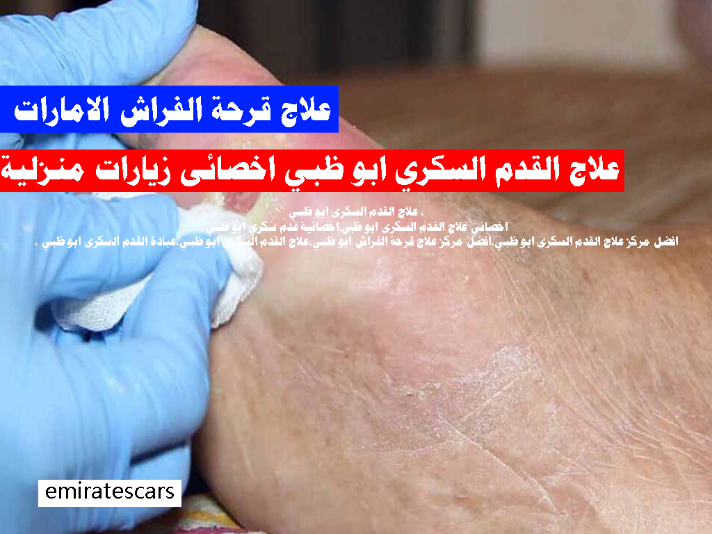 علاج القدم السكري ابو ظبي اخصائى منزلي
