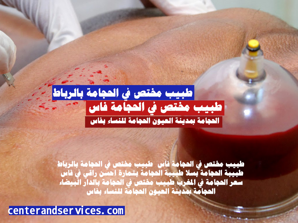 الحجامة بمدينة العيون الحجامة للنساء بفاس